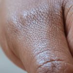 Affected Organs: Which Body Organs Does Mesothelioma Mainly Impact?